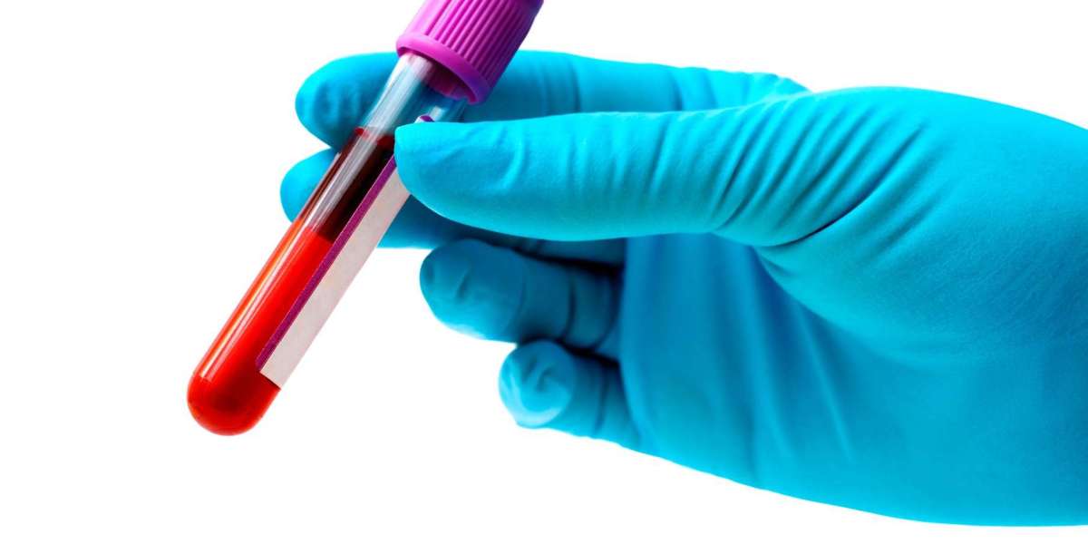 Understanding The Results of Blood Tests for Dogs Why Dog's Need Bloodwork